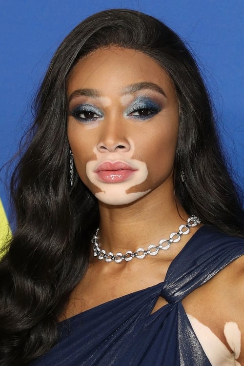 Picture of Winnie Harlow