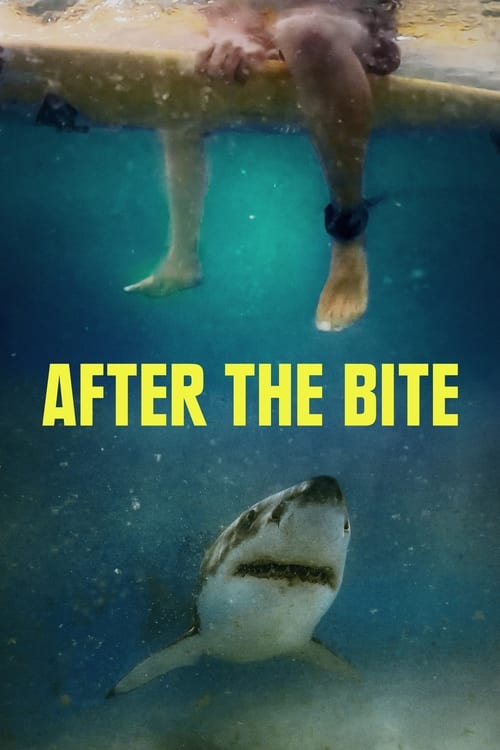 After the Bite